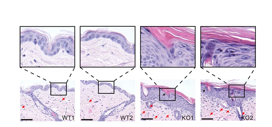 Open access visualization of Microscopy, Dorsal Skin, Wildtype Mice, Knockout Mice, TNF