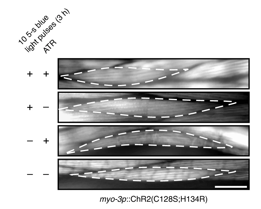 Open access visualization of Microscopy, Fluorescence Micrographs, Rhodamine-Phalloidin, Body Wall Muscle Cells, Worms