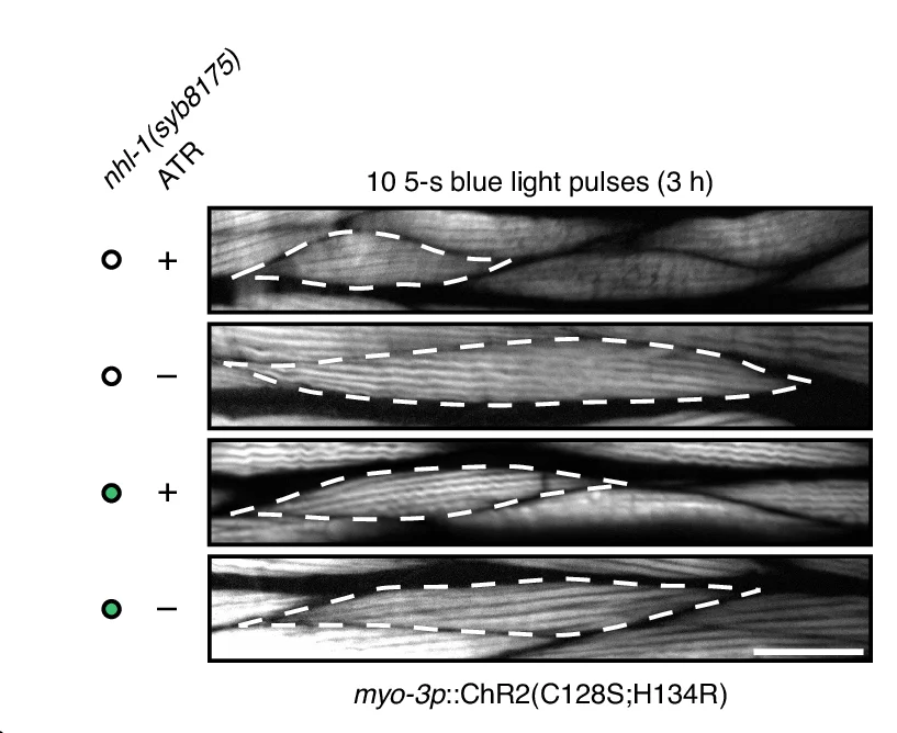Open access visualization of Microscopy, Fluorescence Micrographs, Body Wall Muscle Cells, Rhodamine-Phalloidin
