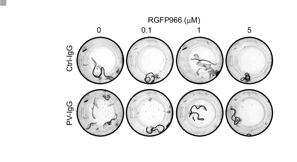 Open access visualization of Photo, Dispase-Based Dissociation Assay, HaCaT Cells, Ctrl, PV-IgG