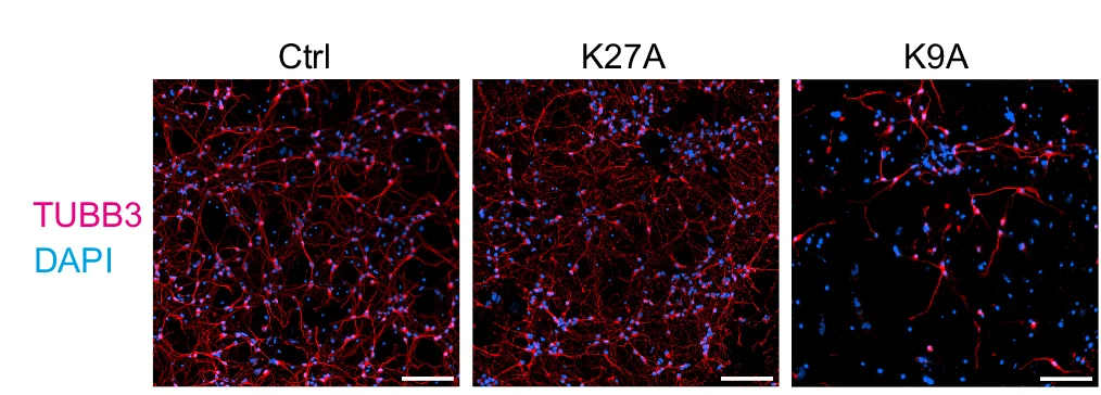Open access visualization of Microscopy, Immunofluorescence, Neurons, TUBB3, DAPI