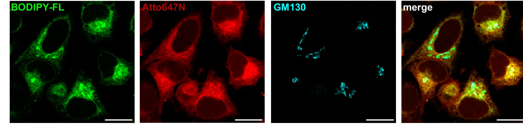 Open access visualization of Microscopy, TFSMs, Golgi, Mitochondria, HeLa Cells