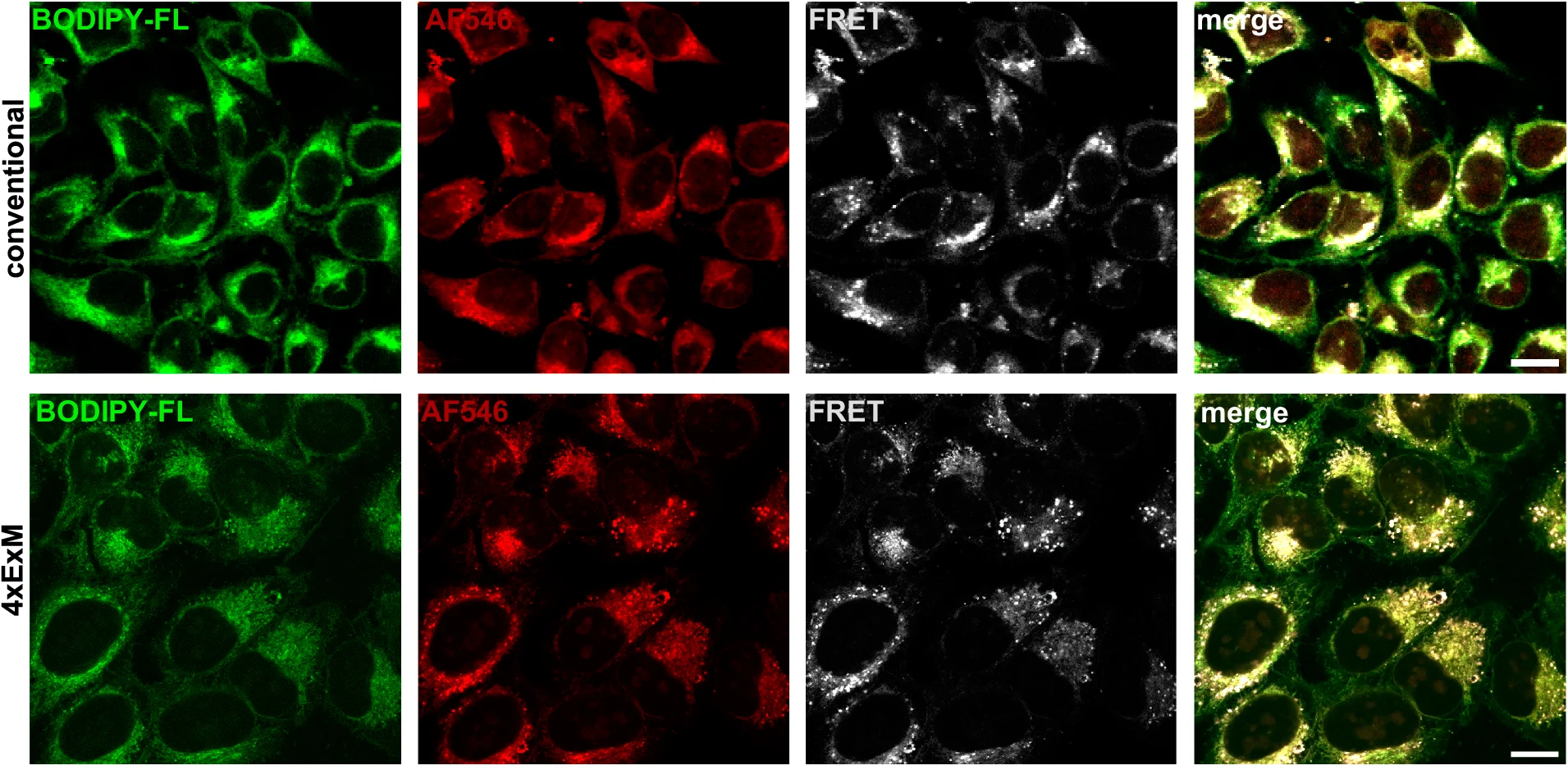 Open access visualization of Microscopy, TFSM, ExM, HeLa Cells, FBS