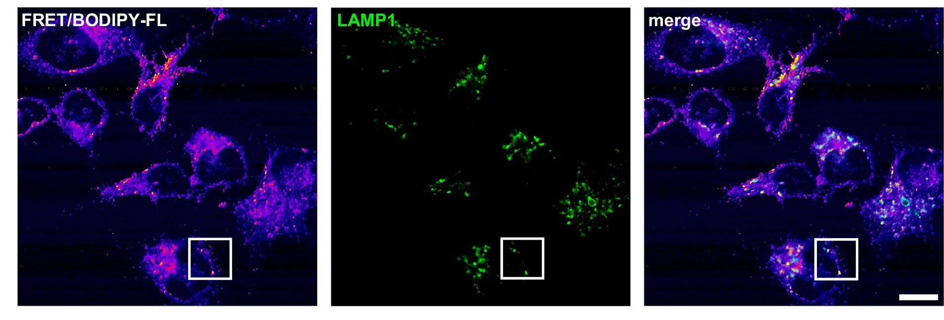 Open access visualization of Microscopy, Lysosomes, SM Content, HeLa Cells, LAMP1