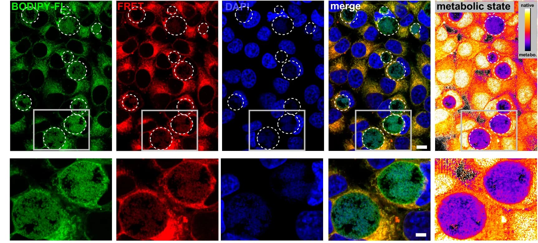 Open access visualization of Microscopy, Chlamydia Inclusions, Host Cell Membranes, HeLa Cells, Confocal Microscope
