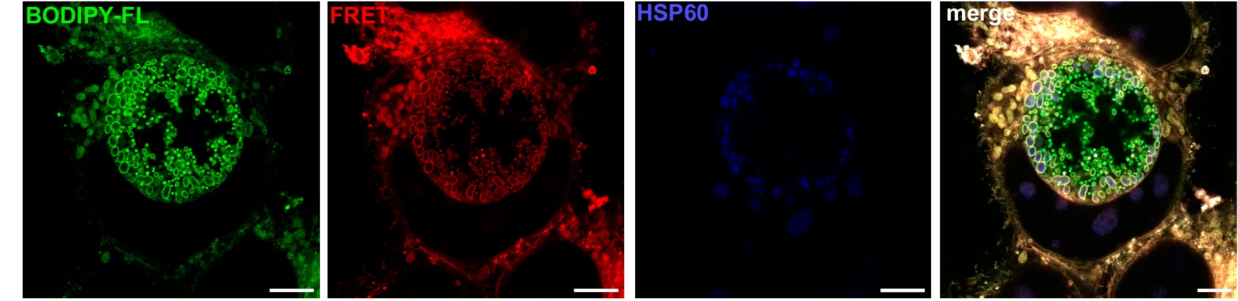 Open access visualization of Microscopy, TFSM, Chlamydial Inclusion, HeLa Cells, C. trachomatis