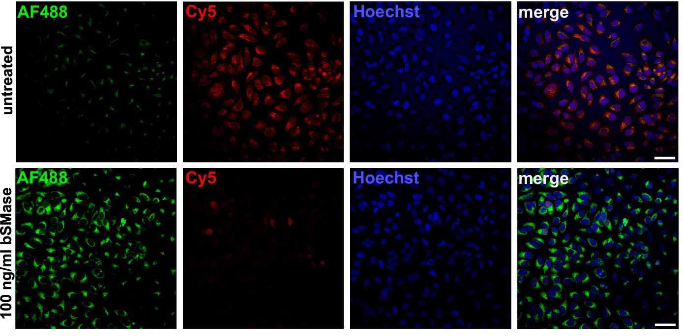 Open access visualization of Microscopy, bSMase, HeLa Cells, TFSM 1, FBS