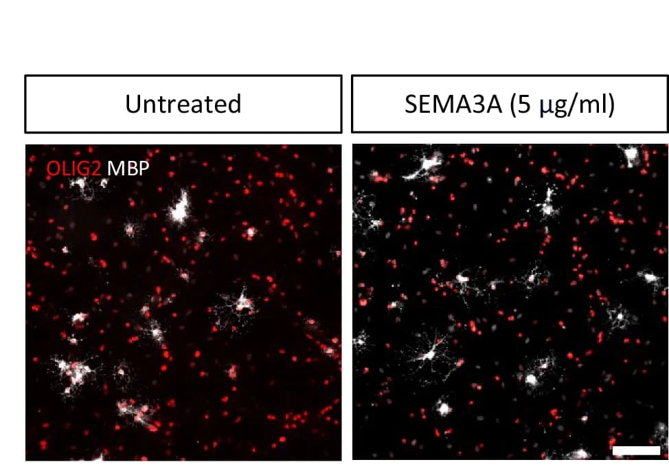 Open access visualization of Microscopy, Representative Images, MBP+ Oligodendrocytes, NRP1, SEMA3A