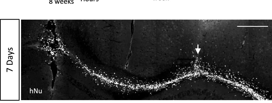 Open access visualization of Microscopy, hNu+ Cells, Corpus Callosum, Cell Migration, Lesion