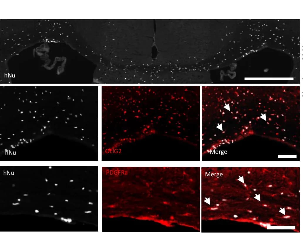 Open access visualization of Microscopy, hNu+ Cells, Corpus Callosum, OLIG2+ Oligodendroglia, PDGFR+ hOPCs