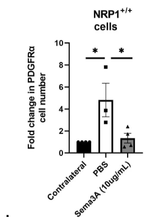 Open access visualization of Bar Plot, Error Bars, NRP1 +/+ PDGFR+ hOPCs, PBS-loaded Lesions, SEMA3A-loaded Lesions