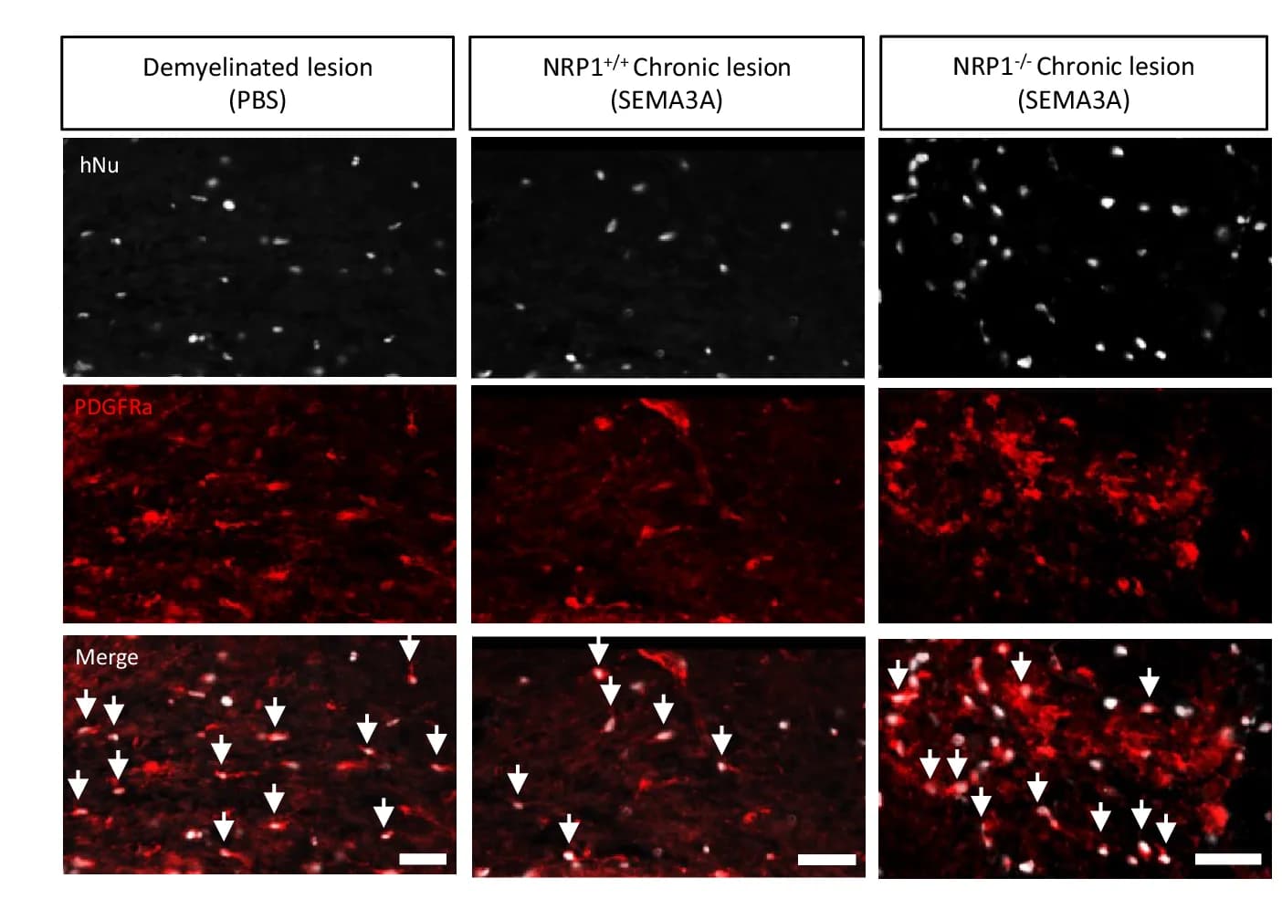 Open access visualization of Microscopy, hNu+PDGFR+ hOPCs, PBS-loaded Lesions, SEMA3A-loaded Lesions, NRP1 +/+ hOPCs