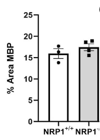 Open access visualization of Bar Plot, Error Bars, Myelination, MBP, Corpus Callosum