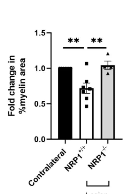 Open access visualization of Bar Plot, Error Bars, MBP, Lesion, Contralateral