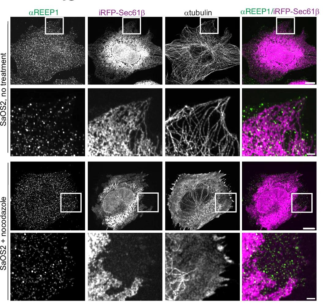 Open access visualization of Microscopy, Endogenous REEP1 Localization, SaOS2 Cells, ER Marker, Sec61beta