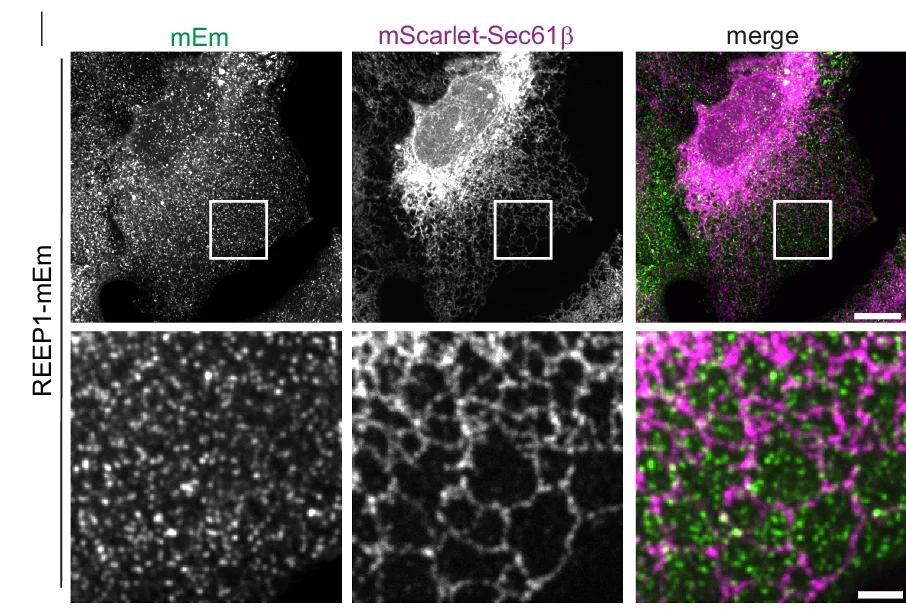 Open access visualization of Microscopy, U2OS Cells, REEP1-mEmerald, ER Marker, mScarlet-Sec61beta