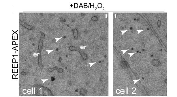 Open access visualization of Microscopy, U2OS Cells, REEP1-APEX, Ascorbate Peroxidase, Diaminobenzidine