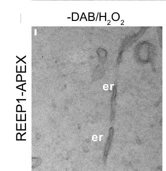 Open access visualization of Microscopy, U2OS Cells, REEP1-APEX, Ascorbate Peroxidase, Electron Microscopy