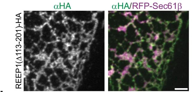 Open access visualization of Microscopy, U2OS Cells, ER Marker, RFP-Sec61β, Hemagglutinin