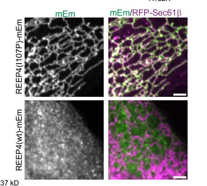 Open access visualization of Microscopy, REEP4 Knockout, U2OS Cells, mEm-fused REEP4, RFP-Sec61β