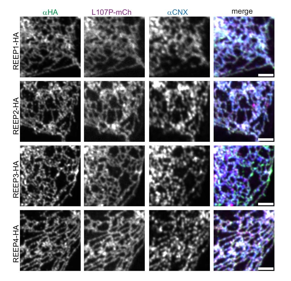 Open access visualization of Microscopy, U2OS Cells, REEP1(Δ102-139)-HA, αHA, αKDEL Antibodies