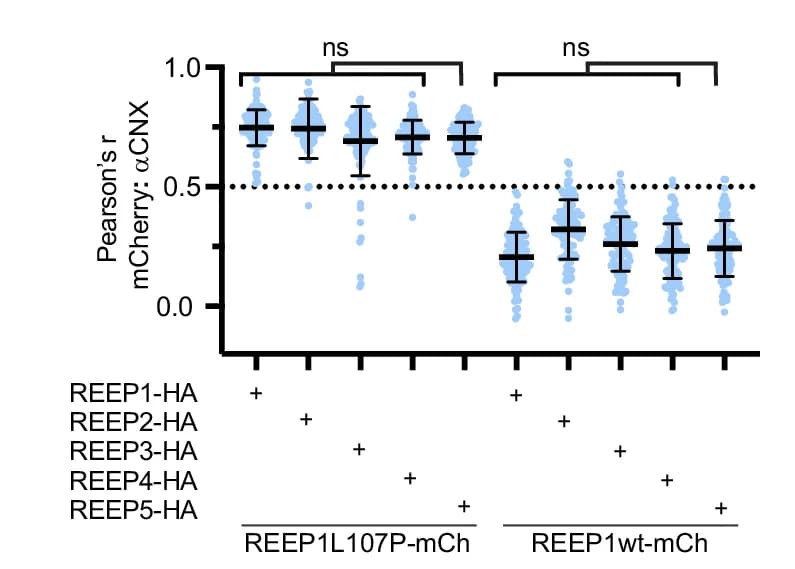 Open access visualization of Scatter Plot, Error Bars, Colocalization, REEP1(L107P)-mCh, REEP1wt-mCh