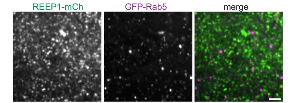 Open access visualization of Microscopy, U2OS Cells, REEP1-mCh, GFP-Rab5, Confocal Microscopy