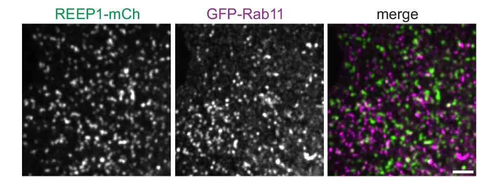 Open access visualization of Microscopy, U2OS Cells, REEP1-mCh, GFP-Rab11, Confocal Microscopy