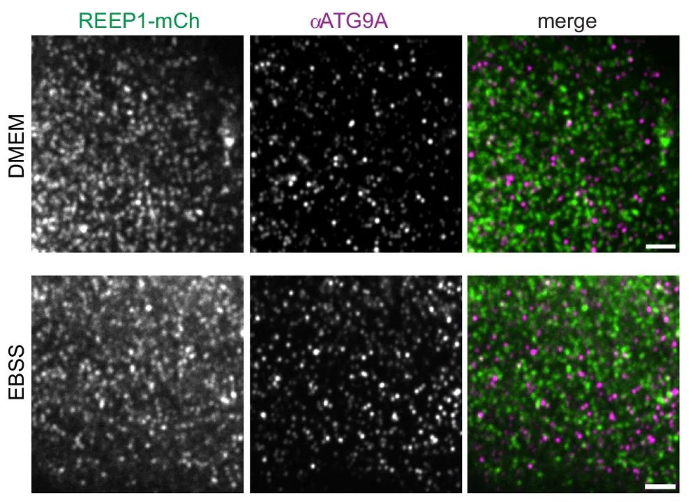 Open access visualization of Microscopy, U2OS Cells, REEP1-mCh, ATG9A Antibodies, Immunostaining