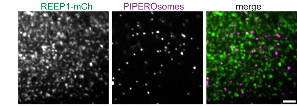 Open access visualization of Microscopy, U2OS Cells, REEP1-mCh, Listeria Phospholipase C, Protein Kinase D