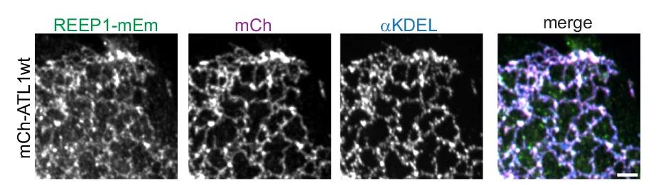 Open access visualization of Microscopy, U2OS Cells, REEP1-mEm, mCherry-ATL1wt, KDEL Antibodies