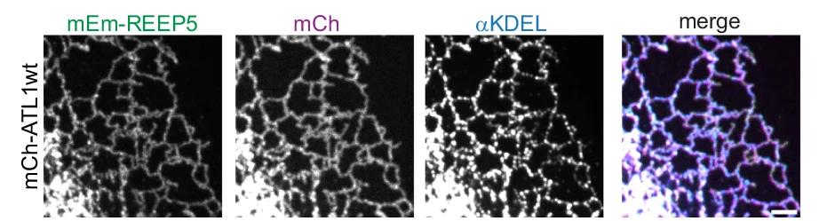 Open access visualization of Microscopy, U2OS Cells, mEm-REEP5, mCherry-ATL1wt, KDEL Antibodies