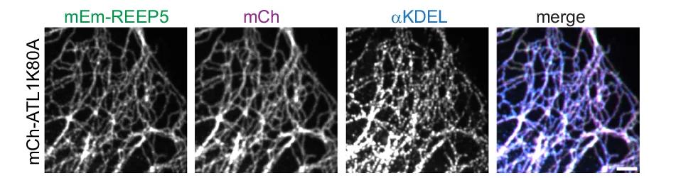 Open access visualization of Microscopy, U2OS Cells, mEm-REEP5, mCherry-ATL1 K80A, KDEL Antibodies