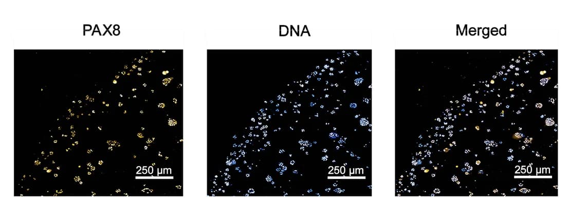Open access visualization of Microscopy, Immunofluorescent Image, Tumor Organoids, Treatment-Naive