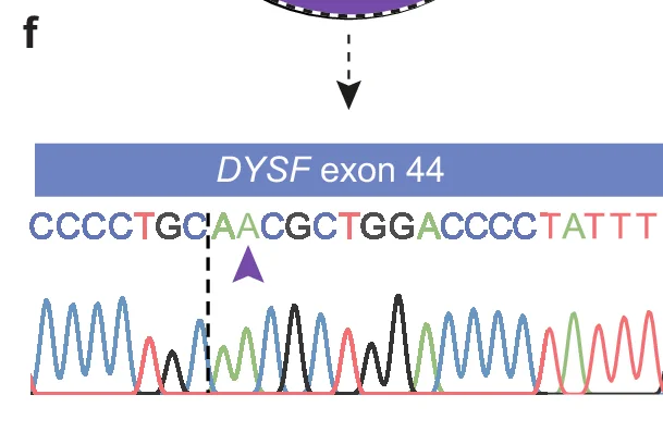 Open access visualization of Sequence Trace, Nucleotide Sequence, DYSF exon 44, Point Mutation, Arrow