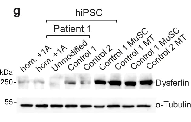 Open access visualization of Western Blot, Dysferlin, alpha-Tubulin, hiPSC, Patient 1