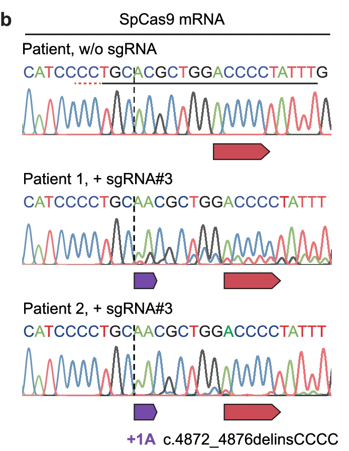 Open access visualization of Sequence Trace, DNA Sequence, SpCas9 mRNA, sgRNA, Patient without sgRNA