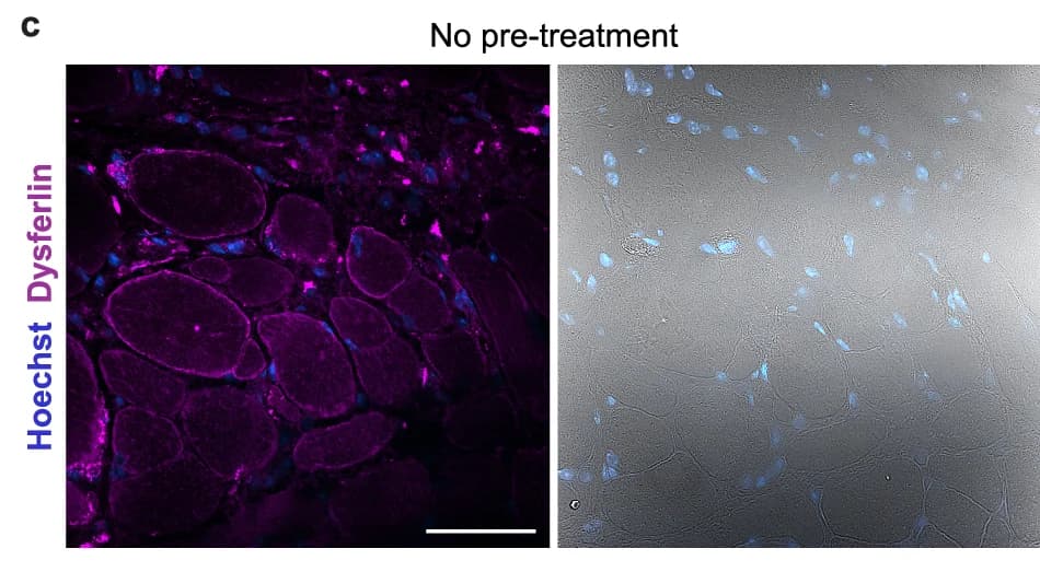 Open access visualization of Immunofluorescence, Microscopy Image, Muscle Tissue, Dysferlin, Hoechst
