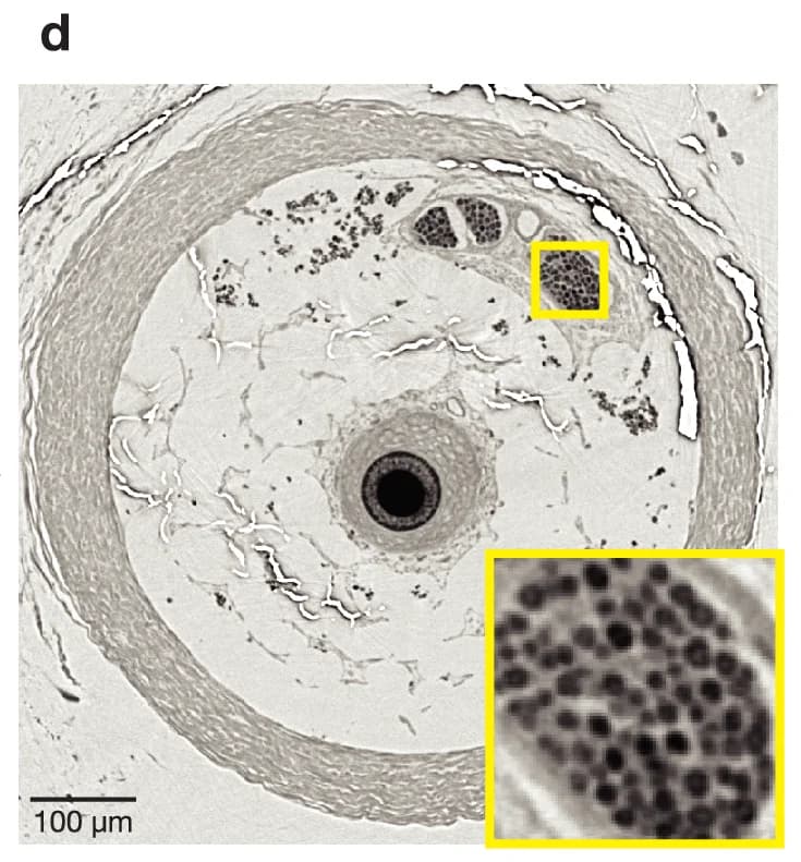 Open access visualization of Microscopic Image, Histology, Cross-section, Nerve Fiber, Nerve Bundle