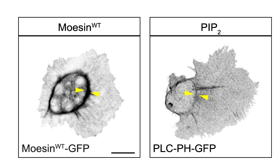 Open access visualization of Microscopy, Moesin, PIP2, PLC-PH-GFP, Hemocyte