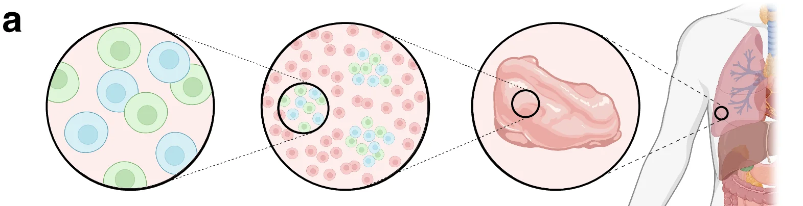 Open access visualization of Diagram, Cell, Lung, Tumor, Anatomy