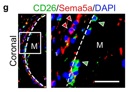 Open access visualization of Immunofluorescence, CD26, Sema5a, DAPI, Coronal