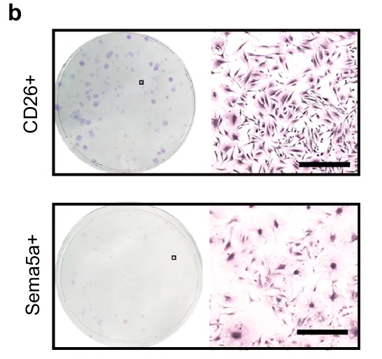 Open access visualization of Microscopy, Cell Culture, CD26+, Sema5a+, Colony Formation Assay