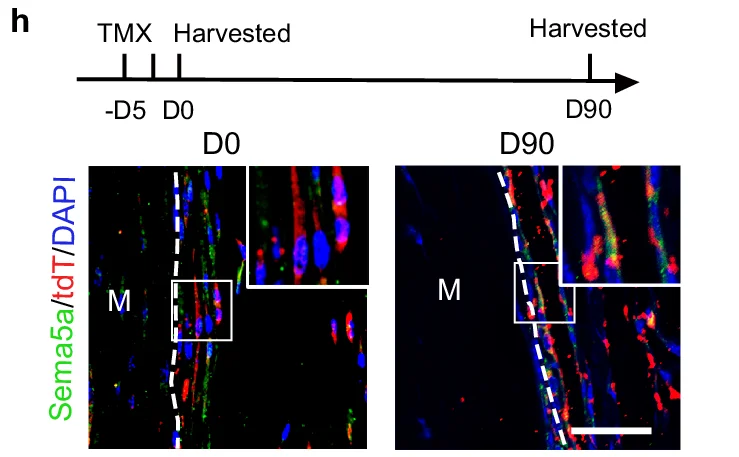 Open access visualization of Timeline, Microscopy, Immunofluorescence, Sema5a, tdT