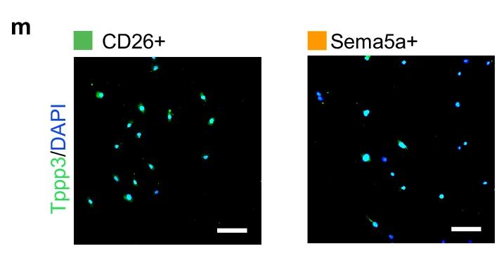 Open access visualization of Immunofluorescence, Microscopy, CD26+, Sema5a+, Tppp3/DAPI