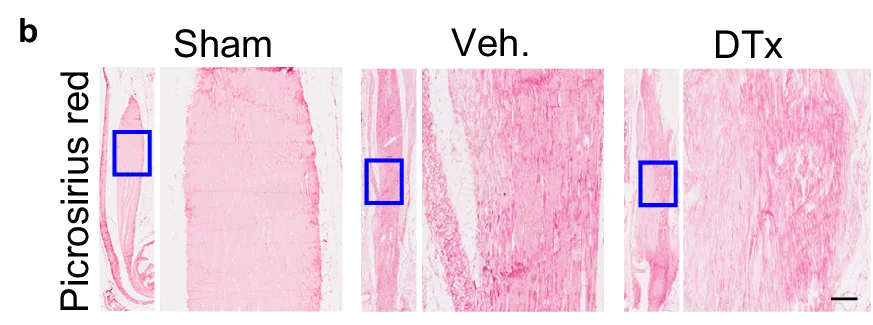 Open access visualization of Microscopic images, Picrosirius red staining, Sham, Veh, DTx