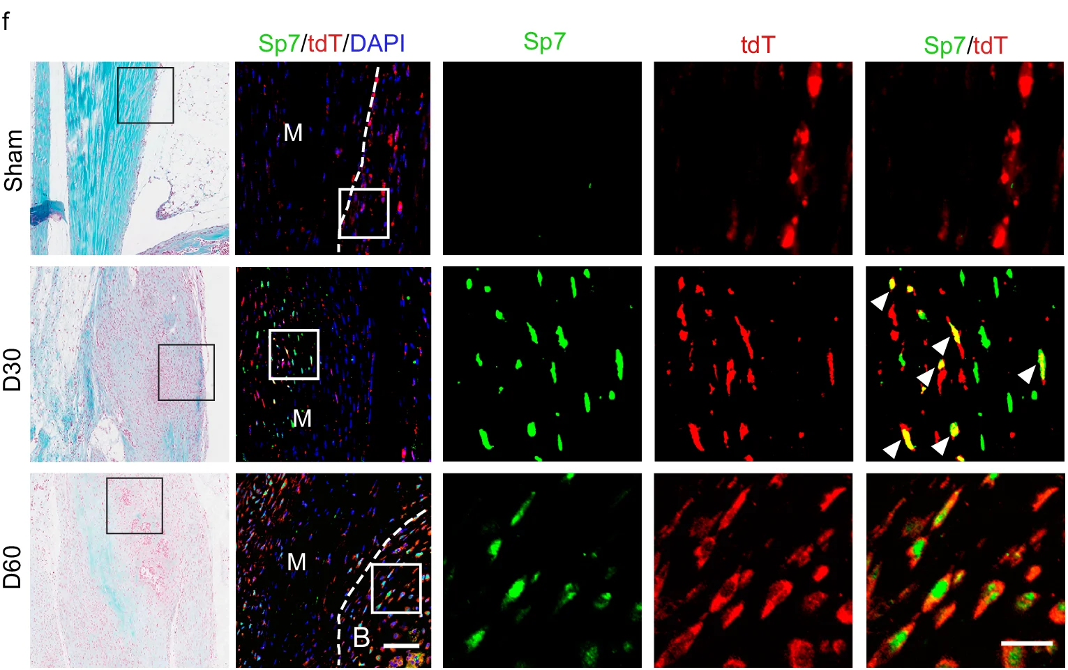 Open access visualization of Immunofluorescence, Microscopy, Sp7, tdT, DAPI