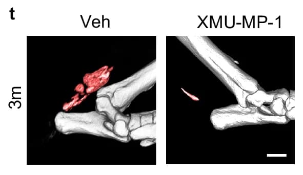 Open access visualization of 3D Rendering, Bone, Veh, XMU-MP-1, Ossification