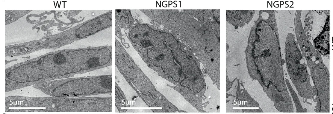 Open access visualization of Microscopy, Transmission Electron Micrographs, Fibroblasts