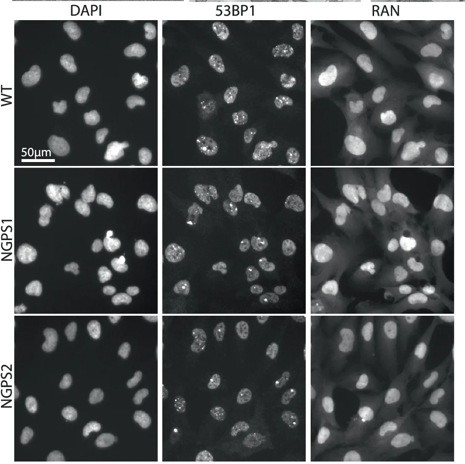 Open access visualization of Microscopy, Immunofluorescence Images, DNA Damage Foci, Nucleocytoplasmic Transport, Fibroblasts